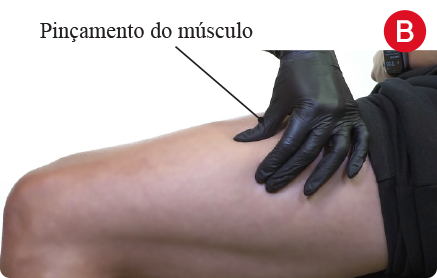 Etapa B