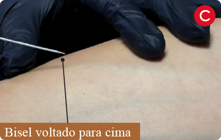 Etapa C