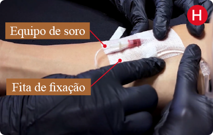 Etapa H